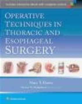 Operative Techniques in Thoracic and Esophageal Surgery Mary Hawn