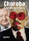 Choroba czerwonych oczu Stanisław Michalkiewicz