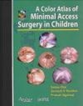 Color Atlas of Minimal Access Surgery in Children Sanjay Oak, Sandesh  V. Parelka, Prakash Agarwal