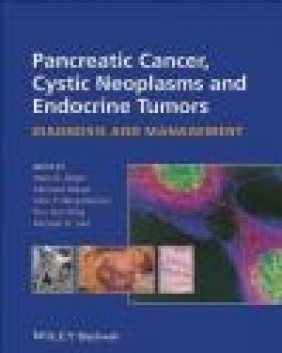 Pancreatic Cancer, Cystic and Endocrine Neoplasm