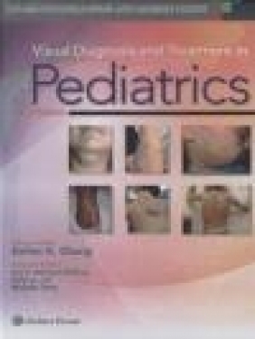 Visual Diagnosis and Treatment in Pediatrics