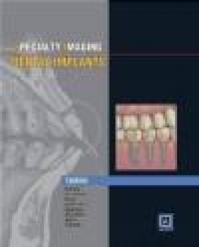 Specialty Imaging: Dental Implants