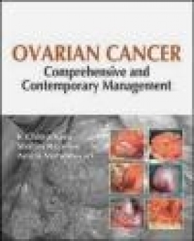 Ovarian Cancer Amita Maheshwari, Shalini Rajaram, K. Chitrathara