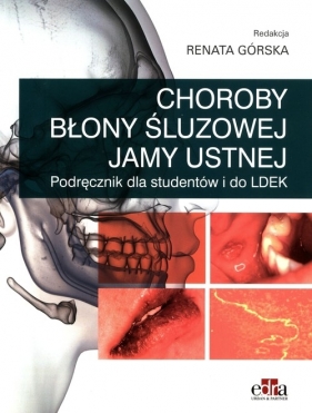 Choroby błony śluzowej jamy ustnej