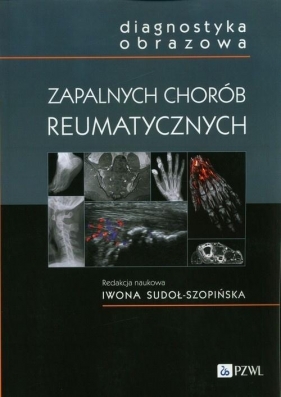 Diagnostyka obrazowa zapalnych chorób.. - Opracowanie zbiorowe