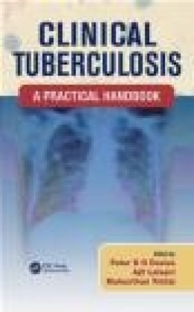 Clinical Tuberculosis Peter Barnes, Stephen Gordon