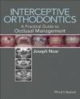 Interceptive Orthodontics Joseph Noar