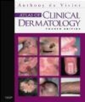 Atlas of Clinical Dermatology Anthony du Vivier, Anthony du Vivier