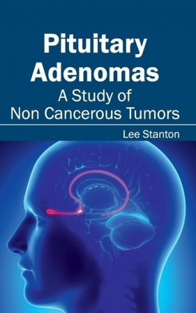 Pituitary Adenomas