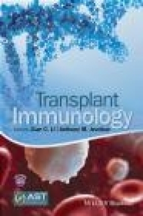 Transplant Immunology Xiang Li, Jevnikar Anthony
