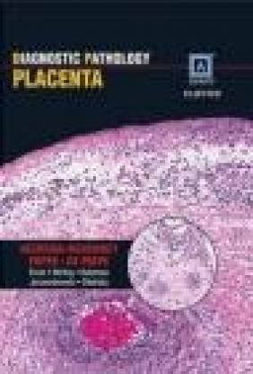 Diagnostic Pathology Placenta Monique De Paepe, Amy Heerema-McKenney, Edwina Popek