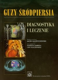 Guzy śródpiersia Diagnostyka i leczenie