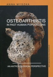 Osteoarthritis in past human populations. An anthropological perspective - Myszka Anna