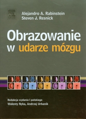 Obrazowanie w udarze mózgu - Steven J. Resnick, Alejandro A. Rabinstein