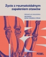 Życie z reumatoidalnym zapaleniem stawów