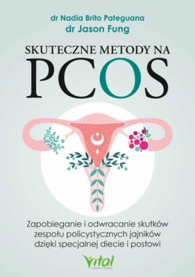 Skuteczne metody na PCOS. Zapobieganie i odwracanie skutków zespołu dr Pateguana Brito Nadia, dr Fung Jason