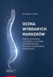 Ocena wybranych markerów obrotu kostnego u chorych z chorobą zwyrodnieniową odcinka lędźwiowego kręg - Grzegorz Liczner