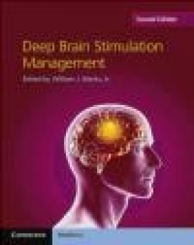 Deep Brain Stimulation Management