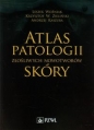 Atlas patologii złośliwych nowotworów skóry - Krzysztof W. Zieliński, Andrzej Kaszuba, Leszek Woźniak