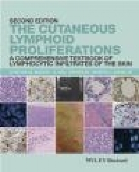 The Cutaneous Lymphoid Proliferations