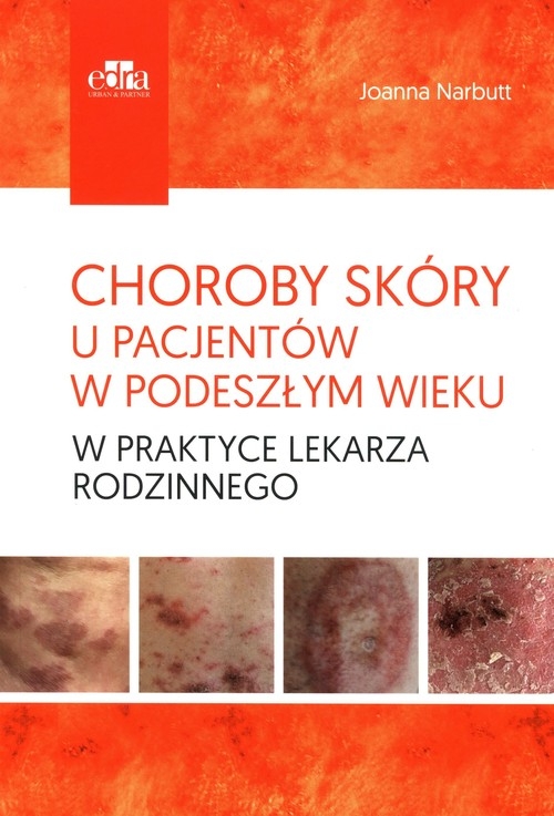 Choroby skóry u pacjentów w podeszłym wieku w praktyce lekarza rodzinnego