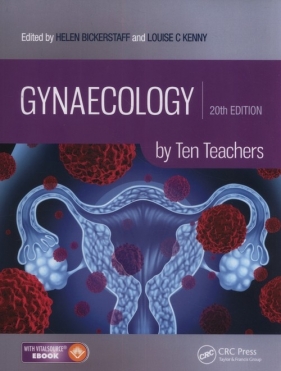 Gynaecology by Ten Teachers - Kenny Louise, Bickerstaff Helen