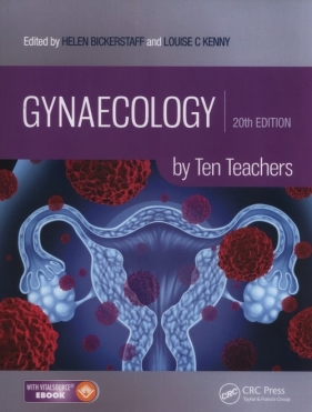 Gynaecology by Ten Teachers - Louise Kenny, Helen Bickerstaff