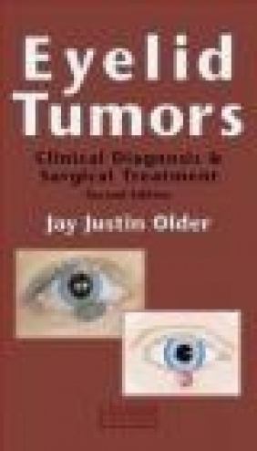 Eyelid Tumours Jay Justin Older, R Older