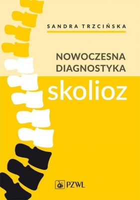 Nowoczesna diagnostyka skolioz - Sandra Trzcińska, Kamil Koszela, Andrzej Myśliwiec, Arkadiusz Żurawski