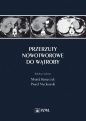 Przerzuty nowotworowe do wątroby - Paweł Nyckowski, Marek Krawczyk