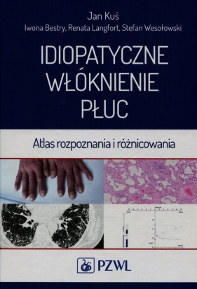 Idiopatyczne włóknienie płuc - Jan Kuś, Iwona Bestry, Renata Langfort