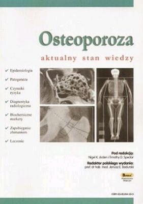 OSTEOPOROZA AKTUALNY STAN WIEDZY - PRACA ZBIOROWA. NIGEL ARDEN. TIMOTHY SPECTOR