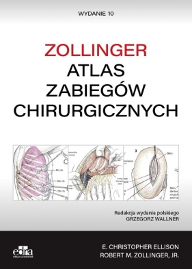 Atlas zabiegów chirurgicznych. Zollinger - E. Christopher Ellison, Robert M. Zollinger