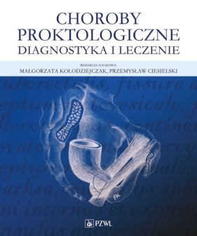 Choroby proktologiczne - Kołodziejczak Małgorzata, Ciesielski Przemysław 