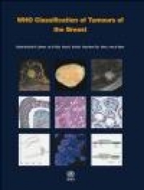 WHO Classification of Tumours of the Breast 4e International Agency for Research on Cancer,  International Agency for Research on Cancer, I.O. Ellis