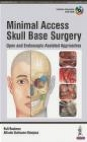 Minimal Access Skull Base Surgery Kofi Boahene