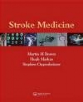 Stroke Medicine Stephen Oppenheimer, Martin M. Brown, Hugh Markus