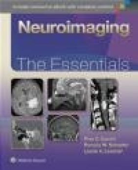 Neuroimaging