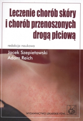 Leczenie chorób skóry i chorób przenoszonych drogą płciową - Szepietowski Jacek, Reich Adam