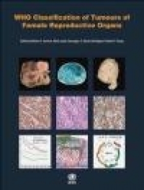 WHO Classification of Tumours of the Female Reproductive Organs International Agency for Research on Cancer, R. J. Kurman,  International Agency for Research on Cancer