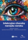 Infekcyjne choroby narządu wzroku Agnieszka Kubicka-Trząska, Bożena Romanowska-Dixon