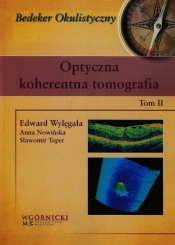 Optyczna koherentna tomografia Tom 2 - Wylęgała Edward, Nowińska Anna, Teper Sławomir