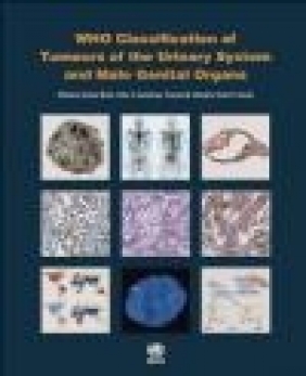 Who Classification of Tumours of the Urinary System and Male Genital Organs International Agency for Research on Cancer