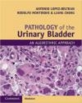 Pathology of the Urinary Bladder Liang Cheng, Rodolfo Montironi, Antonio Lopez-Beltran