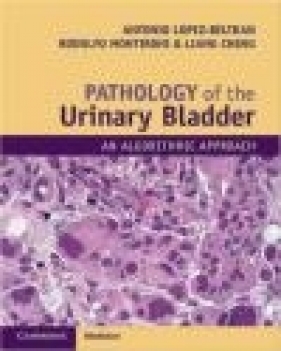 Pathology of the Urinary Bladder - Liang Cheng, Rodolfo Montironi, Antonio Lopez-Beltran
