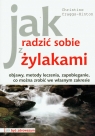 Jak radzić sobie z żylakami