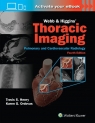 Webb & Higgins Thoracic Imaging: Print + eBook with Multimedia Travis Scott Henry