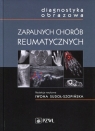 Diagnostyka obrazowa zapalnych chorób reumatycznych Sudoł-Szopińska  Iwona