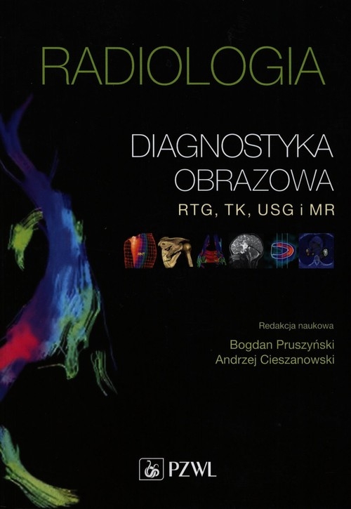 Radiologia Diagnostyka obrazowa RTG, TK, USG i MR (Uszkodzona okładka)