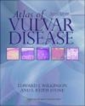 Atlas of Vulvar Disease Edward J. Wilkinson, I. Keith Stone, E Wilkinson